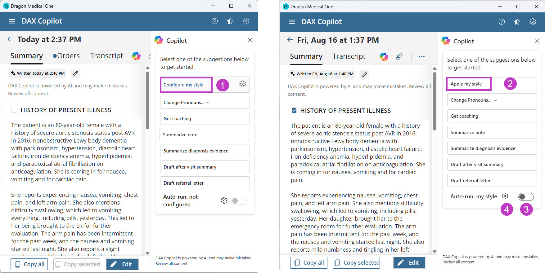 The first AI action button on the desktop app, displaying wording before the style wizard preferences are set (left) and after (right).